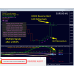 Dynamic Forex28 Navigator v1.3 MT4 